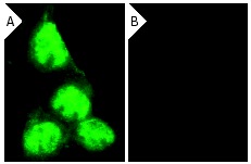  p53 siRNA (h): sc-29435. Immunofluorescence staining of methanol-fixed, control HeLa (A) and p53 siRNA silenced HeLa (B) cells showing diminished nuclear staining in the siRNA silenced cells. Cells probed with p53 (FL-393): sc-6243. 