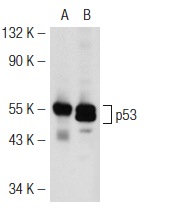  p53 (FL-393): sc-6243. Western blot analysis of p53 expression in non-transfected: sc-117752 (A) and mouse p53 transfected: sc-125766 (B) 293T whole cell lysates.