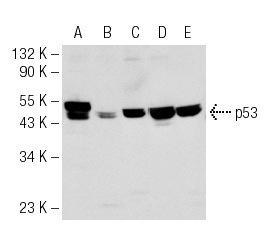  p53 (FL-393): sc-6243. Western blot analysis of p53 expression in A-431 (A), BC<sub>3</sub>H1 (B), MCP-5 (C), Lac Z (D) and WR19L (E) whole cell lysates.