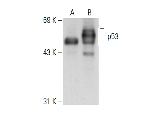  p53 (FL-393): sc-6243. Western blot analysis of p53 expression in non-transfected: sc-117752 (A) and human p53 transfected: sc-158802 (B) 293T whole cell lysates.