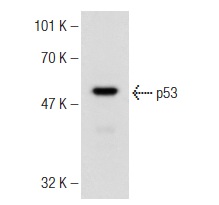  mouse anti-rabbit IgG-HRP: sc-2357. Western blot analysis of p53 expression in Lac-Z whole cell lysate. Antibody tested: p53 (FL-393): sc-6243.