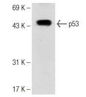  bovine anti-rabbit IgG-HRP: sc-2374. Western blot analysis of p53 expression in Lac-Z whole cell lysate. Antibody tested: p53 (FL-393): sc-6243.