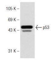  donkey anti-rabbit IgG-HRP: sc-2313. Western blot analysis of p53 expression in Lac-Z whole cell lysate. Antibody tested: p53 (FL-393): sc-6243.