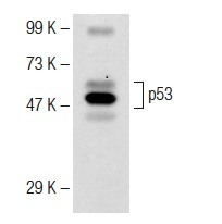  bovine anti-goat IgG-HRP: sc-2352. Western blot analysis of p53 expression in Jurkat whole cell lysate. Antibody tested: p53 (FL-393)-G: sc-6243-G.