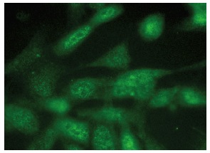  p53 (F-8): sc-374087. Immunofluorescence staining of methanol-fixed NIH/3T3 cells showing nuclear and cytoplasmic localization.