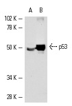  p53 (Pab 240): sc-99. Western blot analysis of p53 expression in A-431 (A) and mouse Lac Z (B) whole cell lysates.