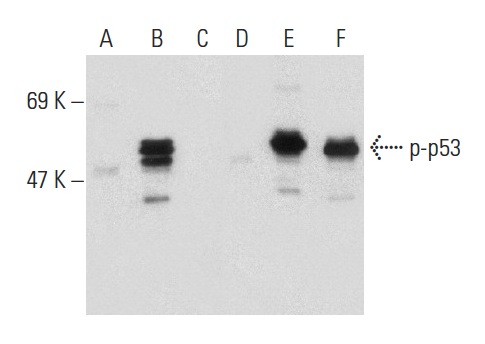  Western blot analysis of p53 phosphorylation in non-transfected: sc-117752 (A,D), untreated human p53 transfected: sc-158802 (B,E) and lambda protein phosphatase (sc-200312A) treated human p53 transfected: sc-158802 (C,F) 293T whole cell lysates. Antibodies tested include p-p53 (Ser 46): sc-101764 (A,B,C) and p53 (Pab 240): sc-99 (D,E,F).