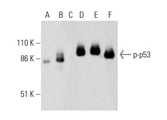  Western blot analysis of p53 phosphorylation in untreated (A,D), ERK2 treated (B,E) and ERK2 and lambda protein phosphatase (sc-200312A) treated (C,F) human recombinant p53. Antibodies tested include p-p53 (Thr 55)-R: sc-12904-R. (A,B,C) and p53 (Pab 240): sc-99 (D,E,F). 