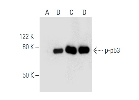  Western blot analysis of p53 phosphorylation in untreated (A,C) and DNA-PK treated (B,D) p53 recombinant proteins. Antibodies tested include p-p53 (Ser 15): sc-101762 (A,B) and p53 (Pab 240): sc-99 (C,D).