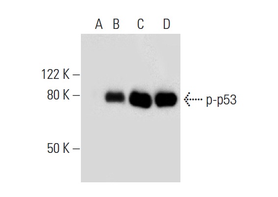  Western blot analysis of p53 phosphorylation in untreated (A,C) and DNA-PK treated (B,D) p53 recombinant proteins. Antibodies tested include p-p53 (Ser 37): sc-135633 (A,B) and p53 (Pab 240): sc-99 (C,D).