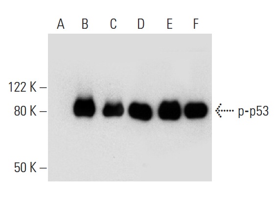  Western blot analysis of p53 phosphorylation in untreated (A,D), CHK 1 treated (B,E) and DNA-PK treated (C,F) p53 recombinant proteins. Antibodies tested include p-p53 (Thr 18)-R: sc-16716-R (A,B,C) and p53 (Pab 240): sc-99 (D,E,F).