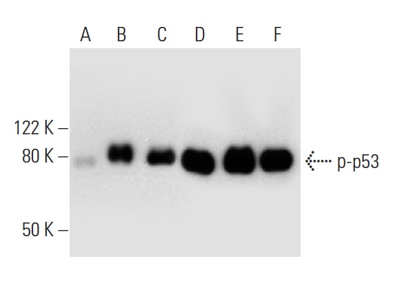  Western blot analysis of p53 phosphorylation in untreated (A,D), CHK 1 treated (B,E) and DNA-PK treated (C,F) p53 recombinant proteins. Antibodies tested include p-p53 (Thr 18): sc-135631 (A,B,C) and p53 (Pab 240): sc-99 (D,E,F).