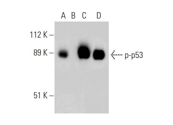  Western blot analysis of p53 phosphorylation in untreated (A,C) and lambda protein phosphatase (sc-200312A) treated (B,D) human recombinant p53. Antibodies tested include p-p53 (Ser 46): sc-101764 (A,B) and p53 (Pab 240): sc-99 (C,D).