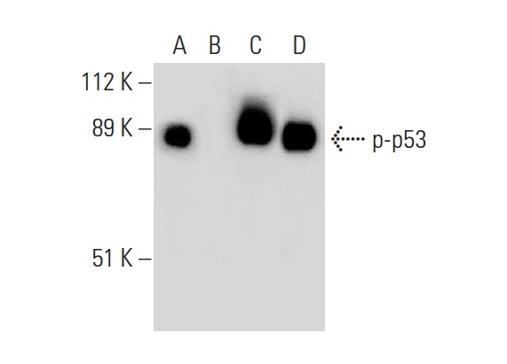  Western blot analysis of p53 phosphorylation in untreated (A,C) and lambda protein phosphatase (sc-200312A) treated (B,D) human recombinant p53. Antibodies tested include p-p53 (F-11): sc-377561 (A,B) and p53 (Pab 240): sc-99 (C,D).