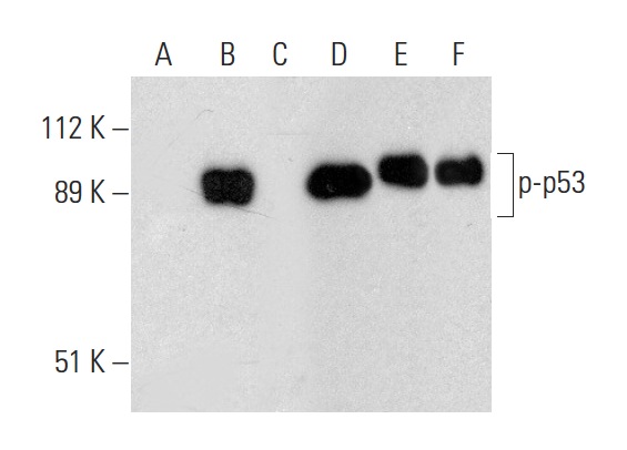  Western blot analysis of p53 phosphorylation in untreated (A,D), CK2a1 treated (B,E) and CK2a1 and lambda protein phosphatase (sc-200312A) treated (C,F) human recombinant p53. Antibodies tested include p-p53 (B-12): sc-377564 (A,B,C) and p53 (Pab 240): sc-99 (D,E,F).