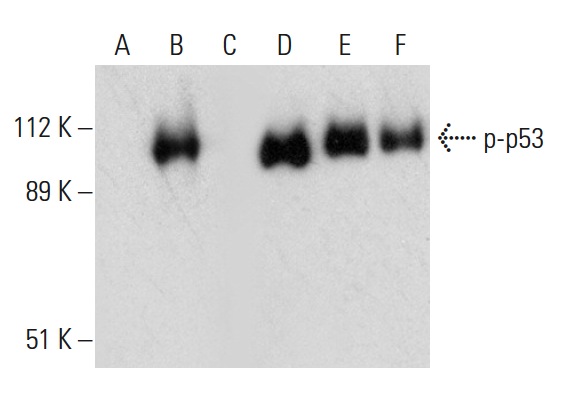  Western blot analysis of p53 phosphorylation in untreated (A,D), CK2a1 treated (B,E) and CK2a1 and lambda protein phosphatase (sc-200312A) treated (C,F) p53 fusion proteins. Antibodies tested include p-p53 (Thr 155): sc-17105 (A,B,C) and p53 (Pab 240): sc-99 (D,E,F).