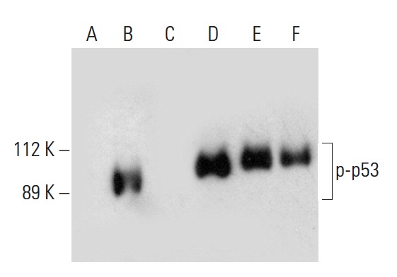  Western blot analysis of p53 phosphorylation in untreated (A,D), CK2a1 treated (B,E) and CK2a1 and lambda protein phosphatase (sc-200312A) treated (C,F) p53 fusion proteins. Antibodies tested include p-p53 (D-9): sc-377567 (A,B,C) and p53 (Pab 240): sc-99 (D,E,F).