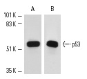  Western blot analysis of p53 expression in A-431 cells (A,B). Antibodies tested include p53 (Bp53-12): sc-263 (A) and p53 (Pab 1801): sc-98 (B).