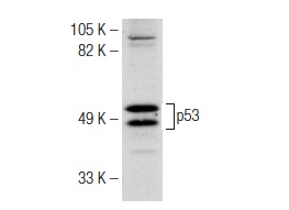  p53 (C-19): sc-1311. Western blot analysis of p53 expression in A-431 whole cell lysate.