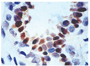  p53 (Bp53-12): sc-263. Immunoperoxidase staining of formalin-fixed, paraffin-embedded normal human breast tissue showing intense nuclear staining of ductal epithelial.