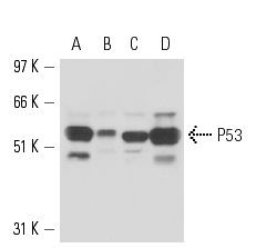  p53 (DO-2): sc-53394. Western blot analysis of p53 expression in A-431 (A), MCF7 (B), BT-20 (C) and MDA-MB-231 (D) whole cell lysates.