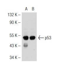  p53 (2B2.68): sc-71817. Western blot analysis of p53 expression in non-transfected: sc-117752 (A) and mouse p53 transfected: sc-125766 (B) 293T whole cell lysates.