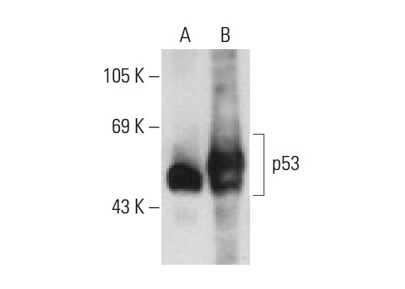  p53 (2B2.68): sc-71817. Western blot analysis of p53 expression in non-transfected: sc-117752 (A) and human p53 transfected: sc-158802 (B) 293T whole cell lysates.