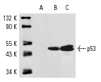  p53 (M-19): sc-1312. Western blot analysis of p53 expression in A-431 (A), WR19L (B) and mouse Lac Z (C) whole cell lysates.