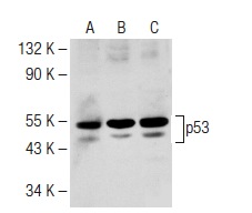  Western blot analysis of p53 expression in mouse Lac Z (A,B,C) whole cell lysate. Antibodies tested include p53 (C-19): sc-1311 (A), p53 (M-19): sc-1312 (B) and p53 (R-19): sc-1313 (C).