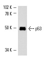  p53 (Pab 246): sc-100. Western blot analysis of p53 expression in mouse Lac Z whole cell lysate.