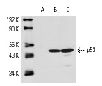  p53 (R-19): sc-1313. Western blot analysis of p53 expression in A-431 (A), WR19L (B) and mouse Lac Z (C) whole cell lysates. Note lack of reactivity with human p53 in lane A.