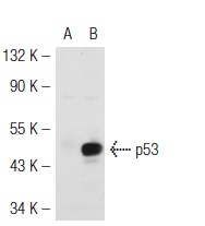  p53 (R-19): sc-1313. Western blot analysis of p53 expression in non-transfected: sc-117752 (A) and mouse p53 transfected: sc-125766 (B) 293T whole cell lysates.