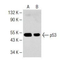  Western blot analysis of p53 expression in mouse Lac Z whole cell lysates (A,B). Antibodies tested include p53 (N-19): sc-1314 (A) and p53 (E-19): sc-1315 (B).