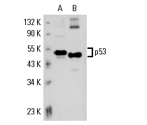  p53 (2Q366): sc-71818. Western blot analysis of p53 expression in A-431 (A) and mouse Lac Z (B) whole cell lysates.