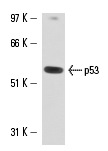  p53 (2Q366): sc-71818. Western blot analysis of p53 expression in mouse Lac Z whole cell lysate.