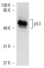  p53 (D-11): sc-17846. Western blot analysis of p53 expression in A-431 whole cell lysate.