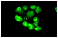  p53 (D-11): sc-17846. Immunofluorescence staining of methanol-fixed A-431 cells showing nuclear localization.