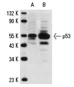  p53 (B-P3): sc-65334. Western blot analysis of p53 expression in MCF7 (A) and BT-20 (B) whole cell lysates.