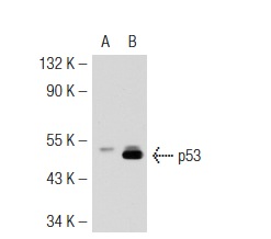  p53 (pAb 122): sc-56182. Western blot analysis of p53 expression in non-transfected: sc-117752 (A) and mouse p53 transfected: sc-125766 (B) 293T whole cell lysates.