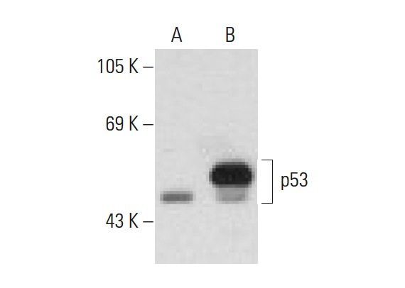  p53 (pAb 122): sc-56182. Western blot analysis of p53 expression in non-transfected: sc-117752 (A) and human p53 transfected: sc-158802 (B) 293T whole cell lysates.