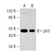  Western blot analysis of p53 expression in mouse Lac Z whole cell lysates (A,B). Antibodies tested include p53 (N-19): sc-1314 (A) and p53 (E-19): sc-1315 (B).