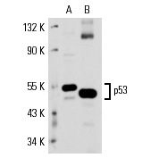  p53 (2B2.71): sc-71819. Western blot analysis of p53 expression in A-431 (A) and mouse Lac Z (B) whole cell lysates.