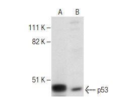  p53 (B20.1): sc-56180. Western blot analysis of p53 expression in HCT 116 (A) and Jurkat (B) whole cell lysates.