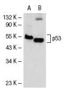  p53 (2Q375): sc-71820. Western blot analysis of p53 expression in A-431 (A) and mouse Lac Z (B) whole cell lysates.