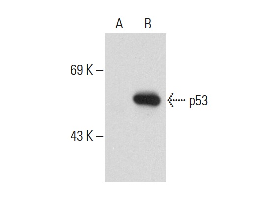  p53 (2Q375): sc-71820. Western blot analysis of p53 expression in non-transfected: sc-117752 (A) and human p53 transfected: sc-158802 (B) 293T whole cell lysates.