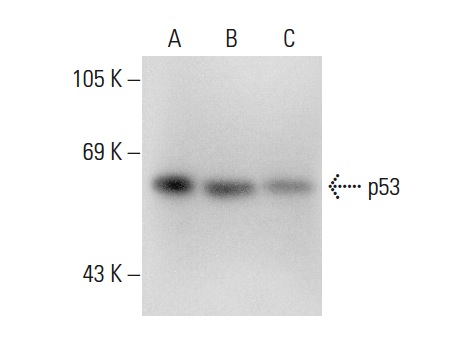  p53 (PAb 1104): sc-53396. Western blot analysis of p53 expression in non-transfected 293T: sc-117752 (A), mouse p53 transfected 293T: sc-125766 (B) and A-431 (C) whole cell lysates.