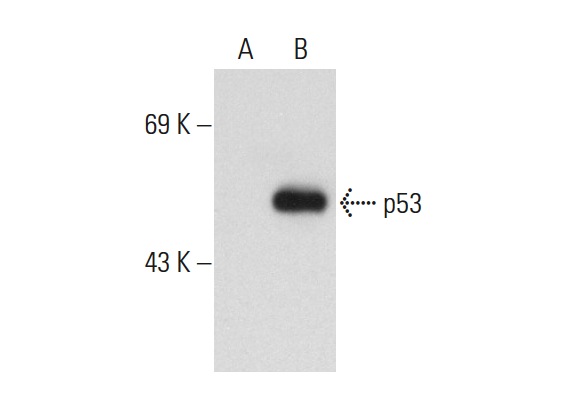  p53 (3H2820): sc-71821. Western blot analysis of p53 expression in non-transfected: sc-117752 (A) and human p53 transfected: sc-158802 (B) 293T whole cell lysates.