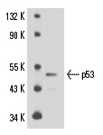  p53 (3H2821): sc-71815. Western blot analysis of p53 expression in mouse Lac Z whole cell lysate.