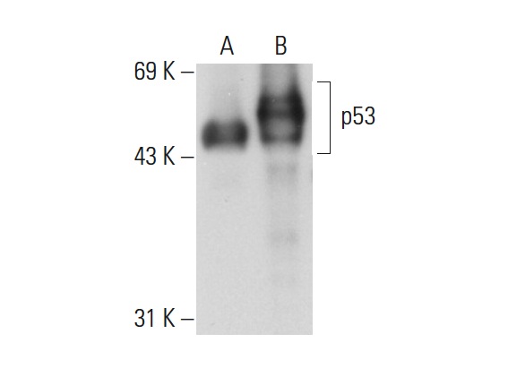  p53 (BP 53.122): sc-73566. Western blot analysis of p53 expression in non-transfected: sc-117752 (A) and human p53 transfected: sc-158802 (B) 293T whole cell lysates.