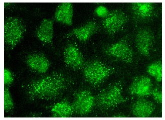  p53 (BP 53.122): sc-73566. Immunofluorescence staining of methanol-fixed HeLa cells showing nuclear localization.